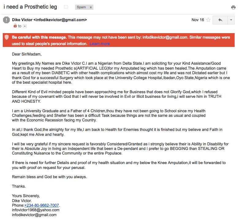 i-need-a-prosthetic-leg